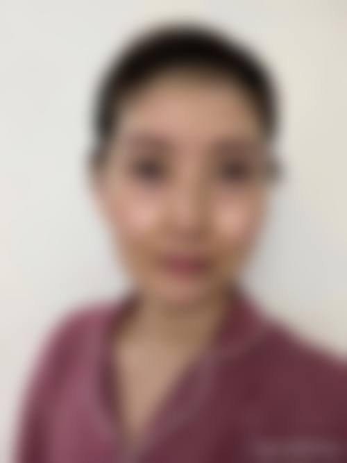 太原有为植发医院怎么样项目特色