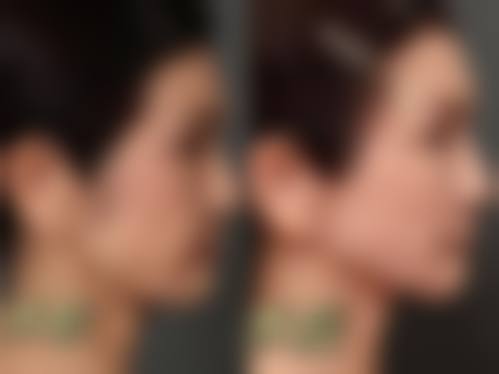 贺州妙善美医疗美容诊所更擅长什么