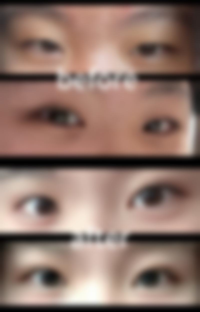 濮阳华美医疗美容诊所价格表