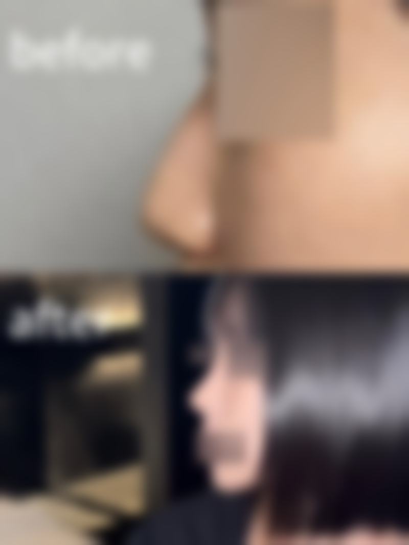 保定中大皮肤病医院项目特色