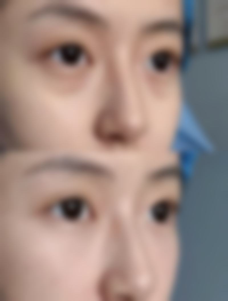 疤痕一直痒是怎么回事？瘢痕增生+神经敏感，3个止痒妙招快收藏！