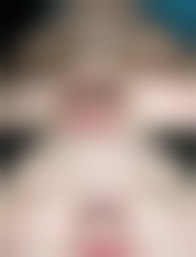 昆明悦玲珑医学美容诊所更擅长什么手术