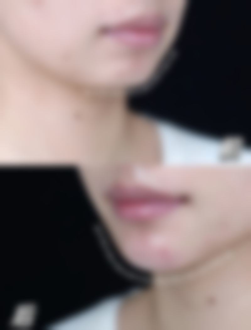 福州米兰医疗美容门诊部怎么样，资质如何