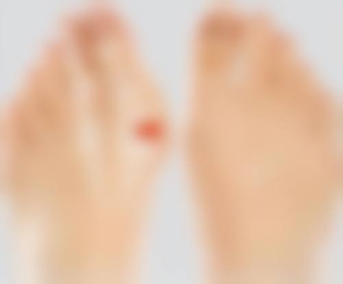 伤口缝针后如何不留疤痕之心理调适：与疤痕和解，拥抱美丽自己