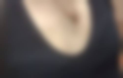 全切双眼皮有疤痕怎么办之预防疤痕的玄学与科学方法