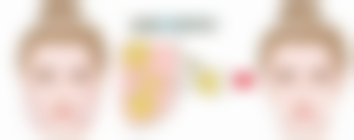 去眼袋有哪些风险：眼部凹陷风险，脂肪去除过多的不良后果