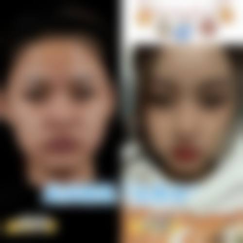 嘉峪关韩美尔医学美容整形门诊部怎么样