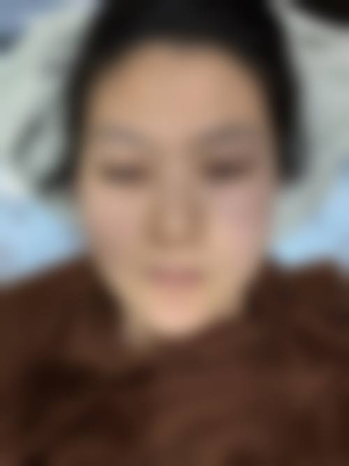 银川鹏爱悦己整形医疗美容门诊部价格表