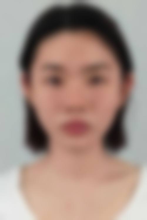 杭州悦可医疗美容诊所邹霞医生的行业地位