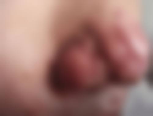 广州南珠整形医院项目特色