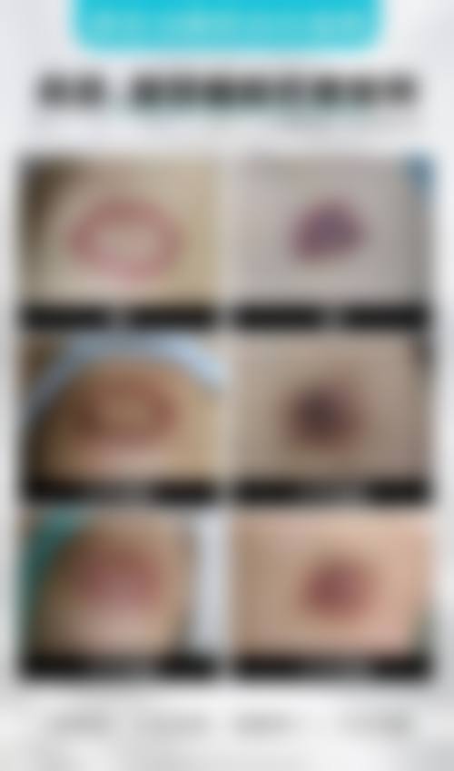 广州南珠整形医院口碑好不好？附真实患者口碑评价