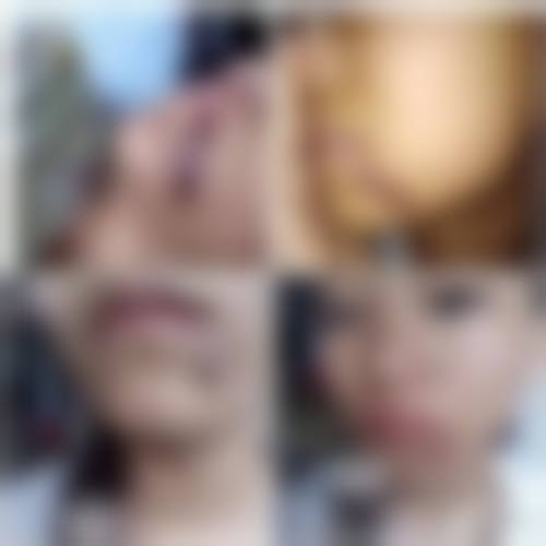 焦作俪人整形医院价格表：收费合理透明