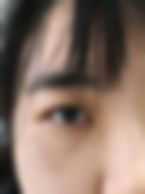 泰州艾菲诗医疗美容门诊部顾客实例