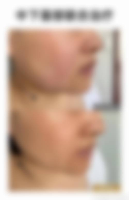 郑州二七方胜医疗美容（中美整形）口碑好不好