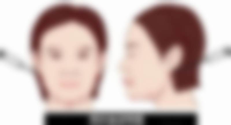 广州高尚医学美容中心龚忠华靠谱吗？韩国博士+10年经验+眼综合大神，设备先进收费透明！