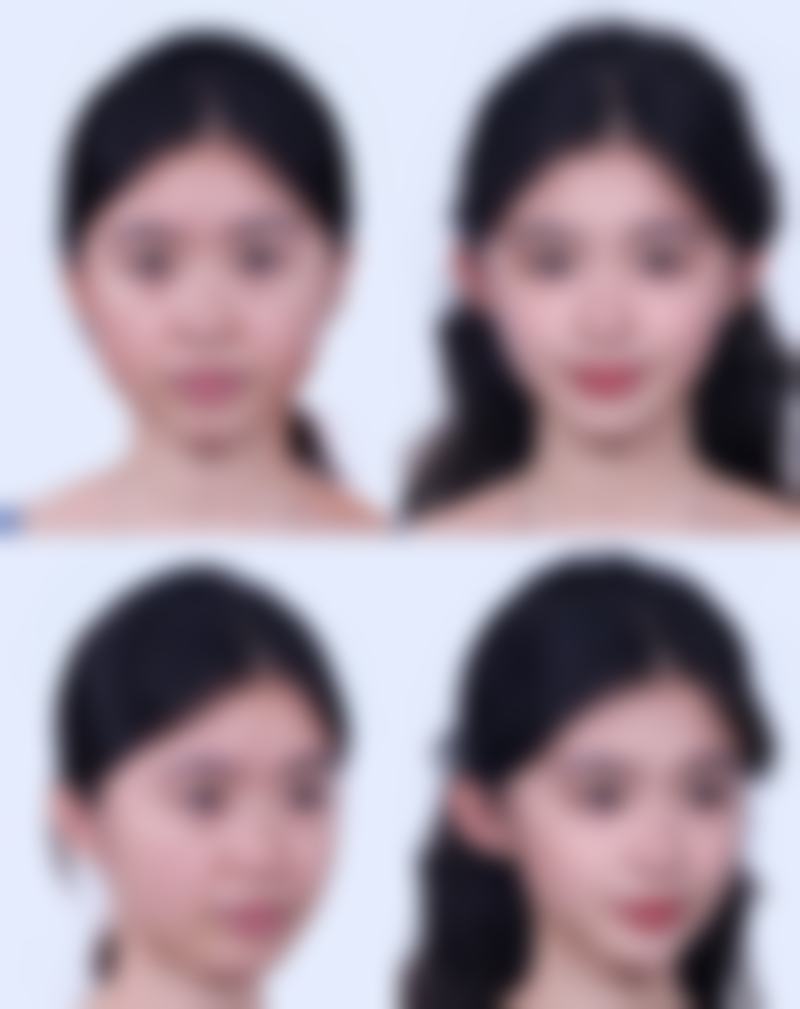 重庆彭水尚诚口腔诊所擅长的手术项目