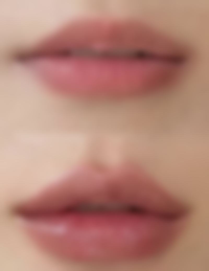 伤口缝针后如何不留疤痕之医院选择与美容缝合：黑科技让疤痕“隐形”