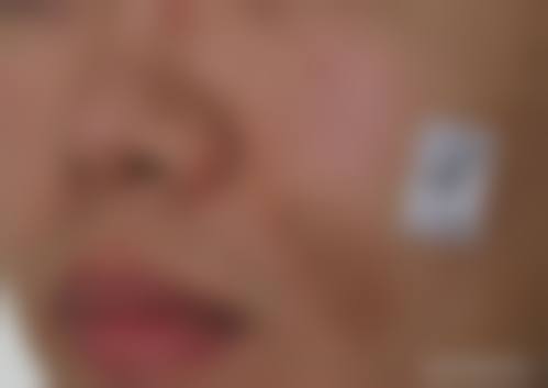 福州格莱美整形医院怎么样，口碑评价如何？