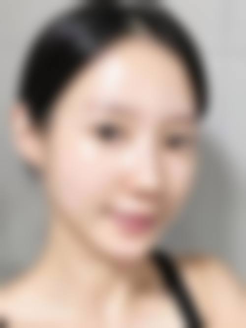 北京张海明整形美容门诊部顾客实例