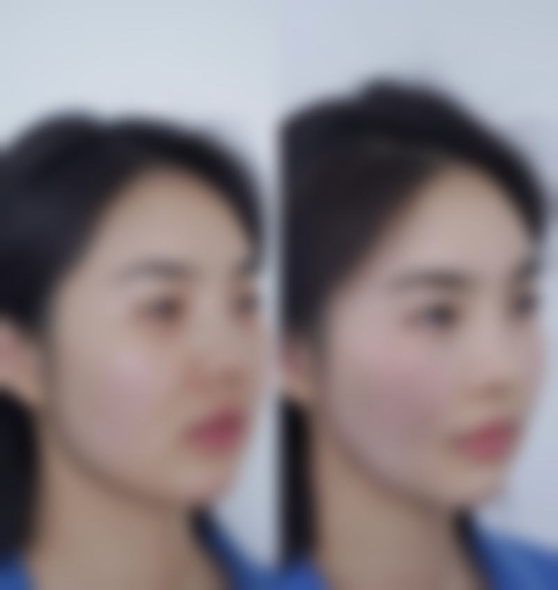 医生没告诉你的“冰敷心机技巧”