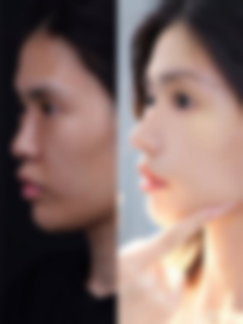 青岛琅梵亚美妍医疗美容怎么样：抖音团购与价格表