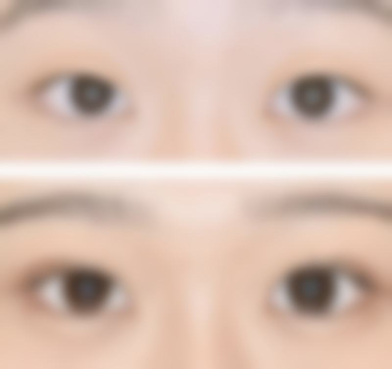 长沙星医美整形美容医院价格表