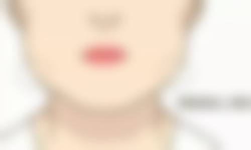 注射隆鼻注射材料的抉择——玻尿酸与胶原蛋白的巅峰对决