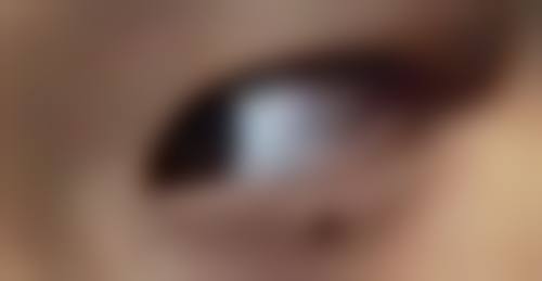 注射隆鼻价格指南——从平价到高端,总有一款适合你