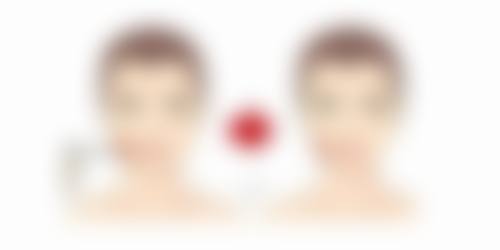 瘦脸针脸下垂怎么办:价格参考(不同城市略有差异)