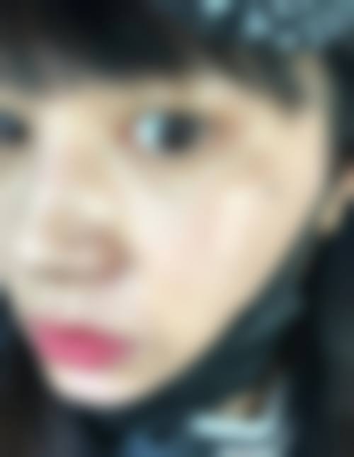 南通英莎医疗美容门诊部李辉评价好不好——南通星范医疗美容门诊部