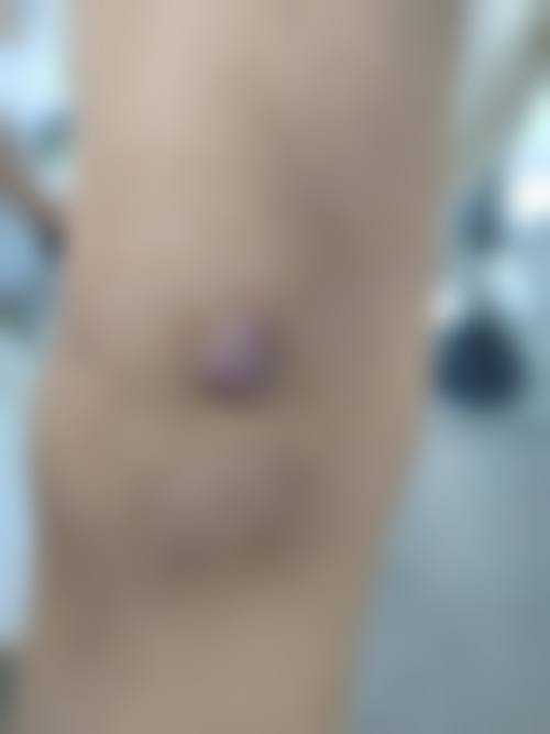 常熟第二人民医院口碑好不好？附真实患者口碑评价