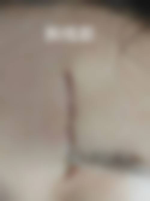 W医院怎么样，口碑评价如何？