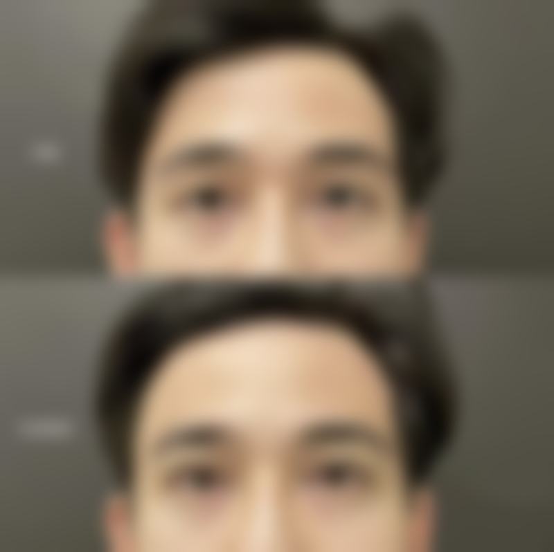 运城市盐湖区人民医院整形科价格表