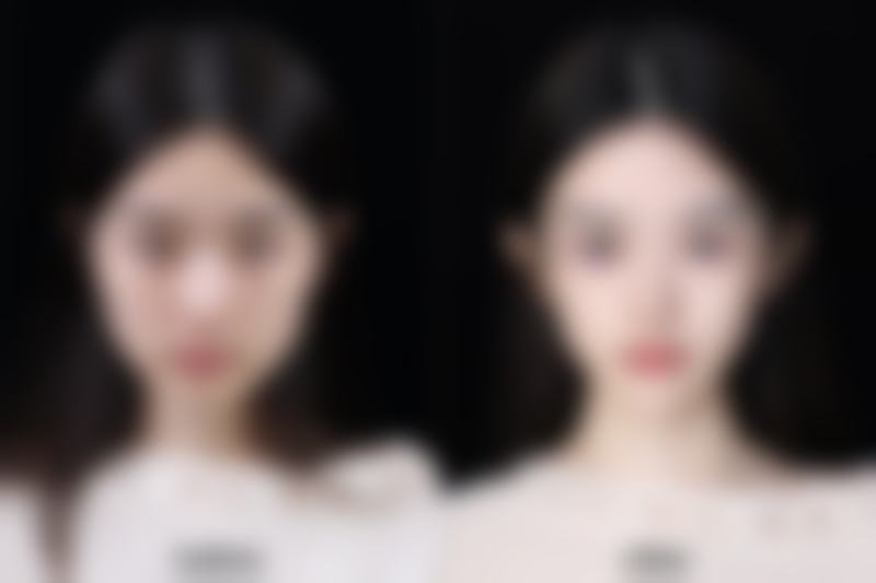 如何更好快速除去眼袋:饮食调理是妙招