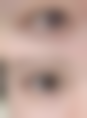 孙豪成医生做手术价格情况