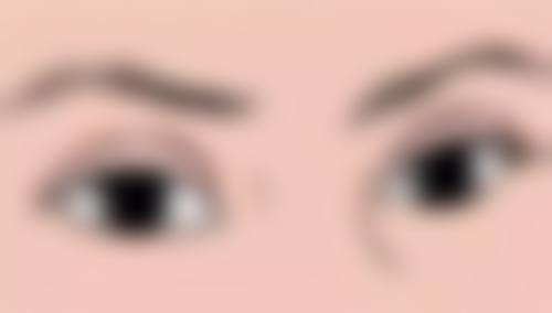 隆鼻子能保持一辈子吗——自体软骨隆鼻的终身之梦