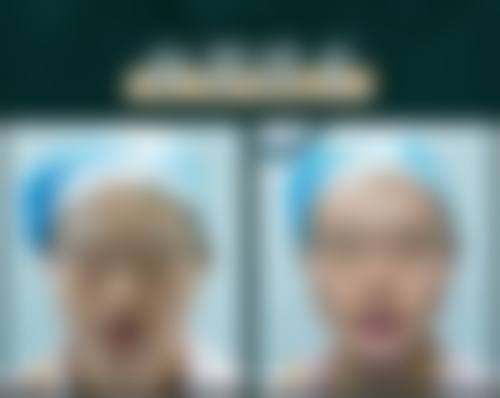 广州高尚医学美容中 心预约挂号流程——西安国际医学中心医院整形医院