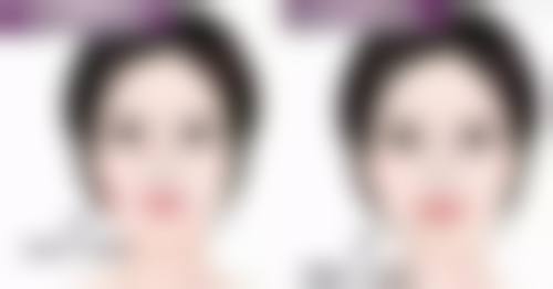 打瘦脸针多久恢复自然？三甲医院vs私立医院效果对比，术后护理关键点