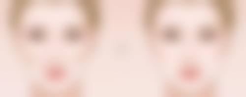 刀疤疤痕如何修复——不同类型疤痕的个性化修复方案