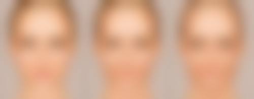 打瘦脸针价格透明表(单位:元/次)