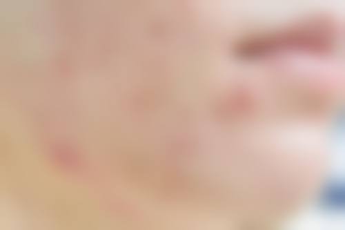 兰州华夏整形美容中 心抖音团购活动和价格表