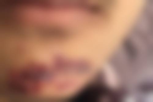 台州中 心医院整形美容激光科价格表