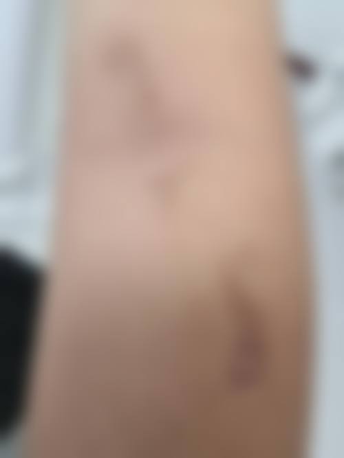 冯先才医生做手术价格