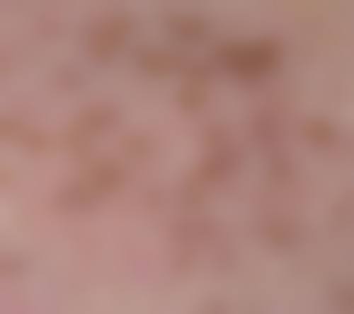 深圳斐研美医疗美容门诊部特色项目怎么样