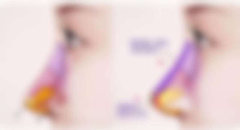 广州高尚医学美容中 心梁衍炜技术特点——重庆美仑美奂整形医院