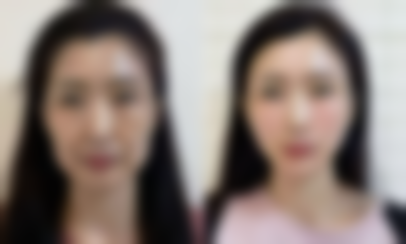 黑眼圈眼袋如何改善之睡眠调整：美容觉的真实力量