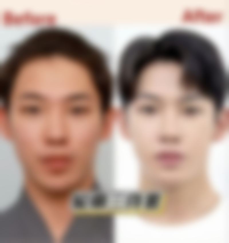 李富玲医生做手术价格