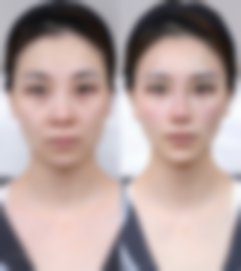 黑眼圈眼袋如何改善之眼霜选择：涂抹式“魔法药水”