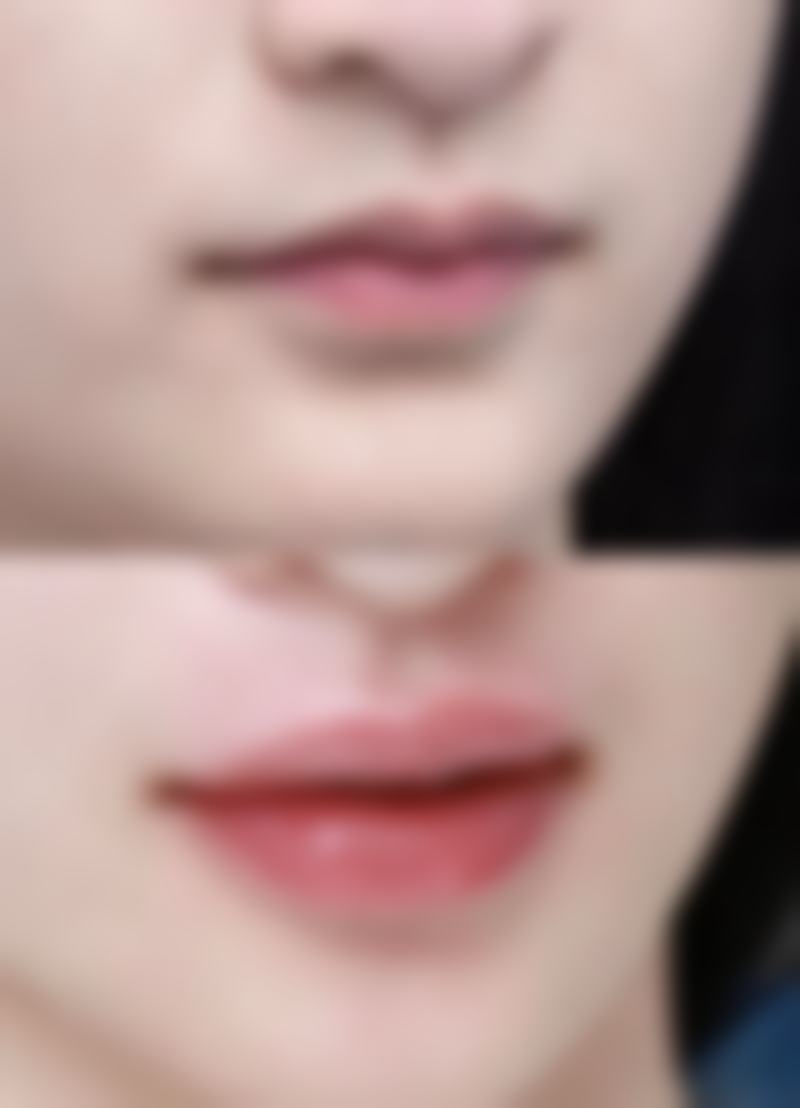 国内各大城市光子嫩肤治疗疤痕医院推荐