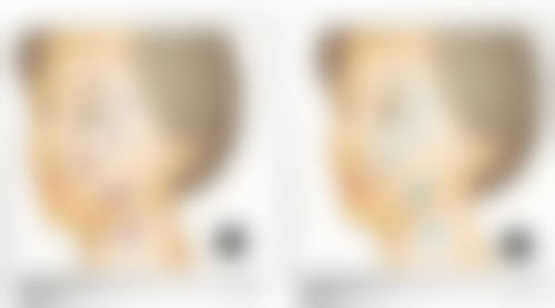 智淑平医生做手术价格